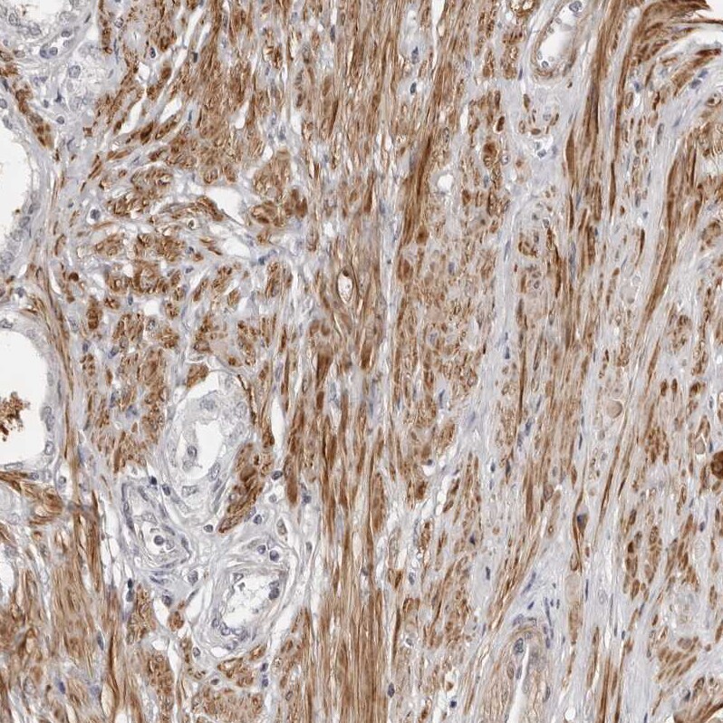 UNK Antibody - BSA Free Immunohistochemistry-Paraffin: UNK Antibody - BSA Free [NBP1-89595]