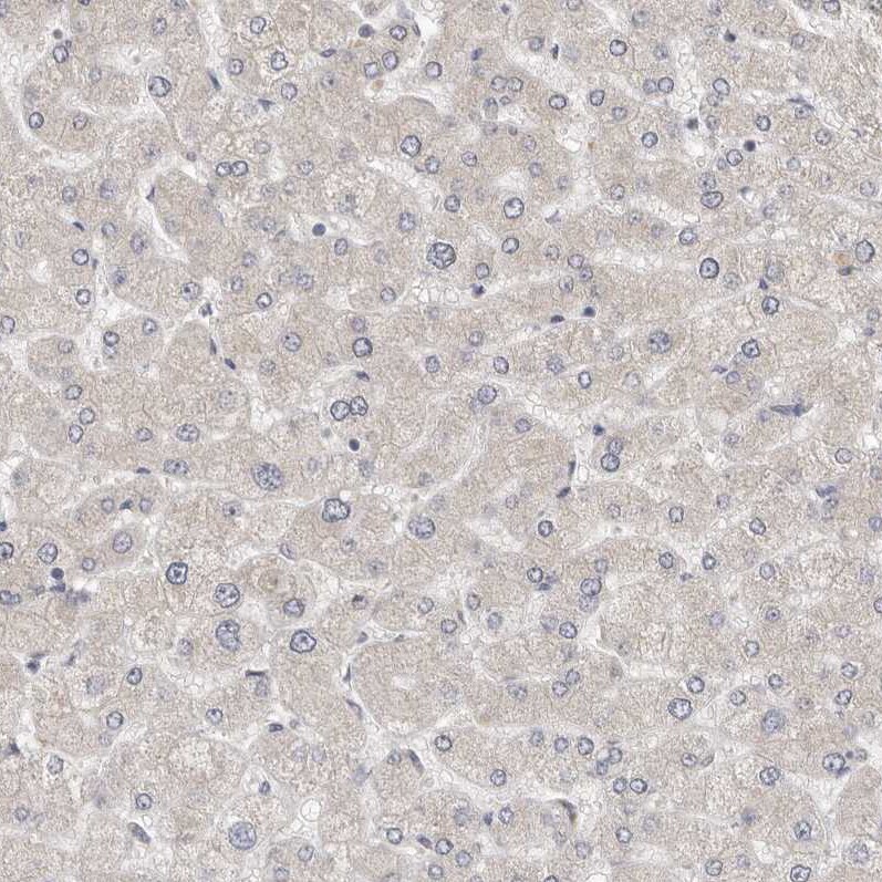 UNK Antibody - BSA Free Immunohistochemistry-Paraffin: UNK Antibody - BSA Free [NBP1-89596]