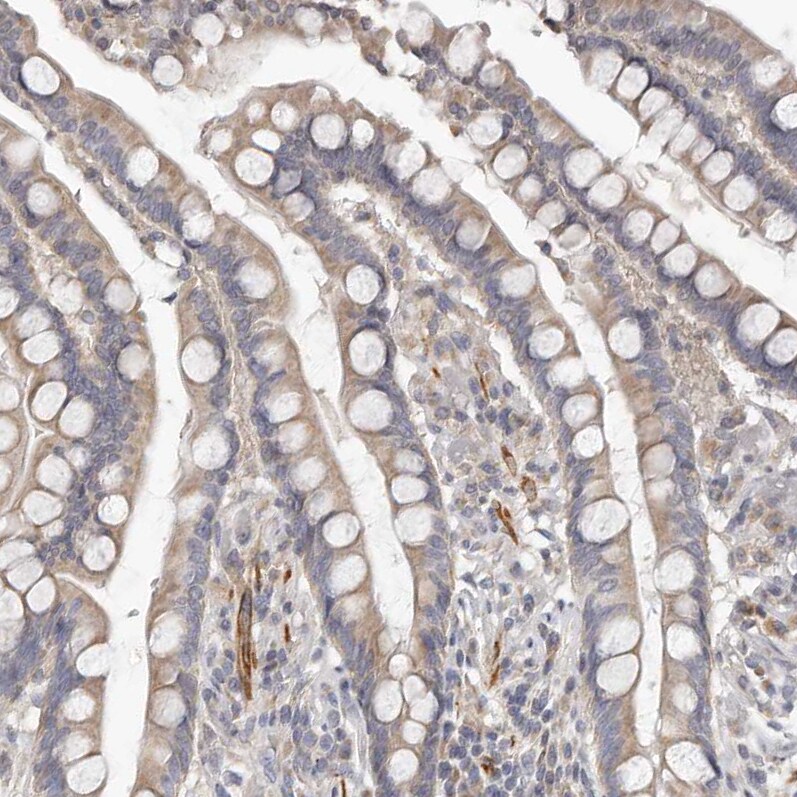 UNK Antibody - BSA Free Immunohistochemistry-Paraffin: UNK Antibody - BSA Free [NBP1-89596]