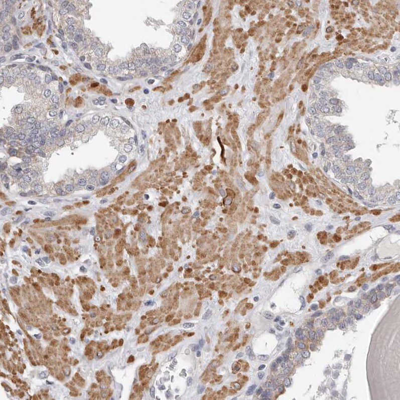 UNK Antibody - BSA Free Immunohistochemistry-Paraffin: UNK Antibody - BSA Free [NBP1-89596]