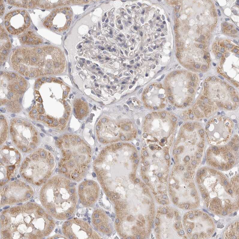 UNK Antibody - BSA Free Immunohistochemistry-Paraffin: UNK Antibody - BSA Free [NBP1-89596]