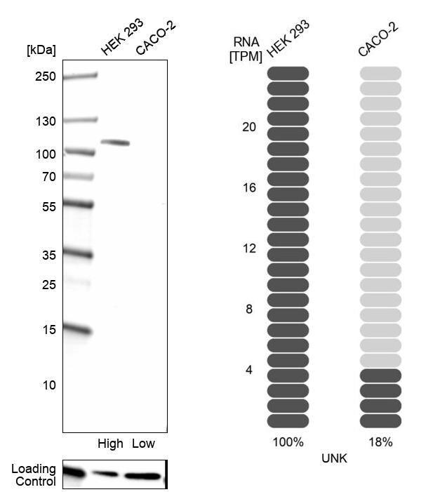 UNK Antibody - BSA Free Western Blot: UNK Antibody - BSA Free [NBP1-89596]