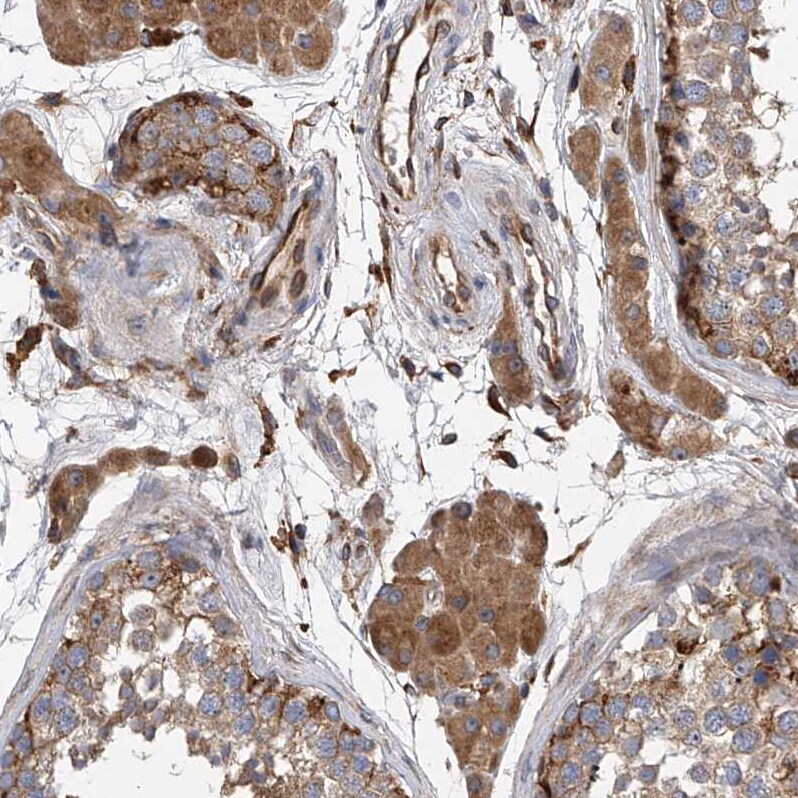 Sec8 Antibody - BSA Free Immunohistochemistry-Paraffin: Sec8 Antibody - BSA Free [NBP1-89597]