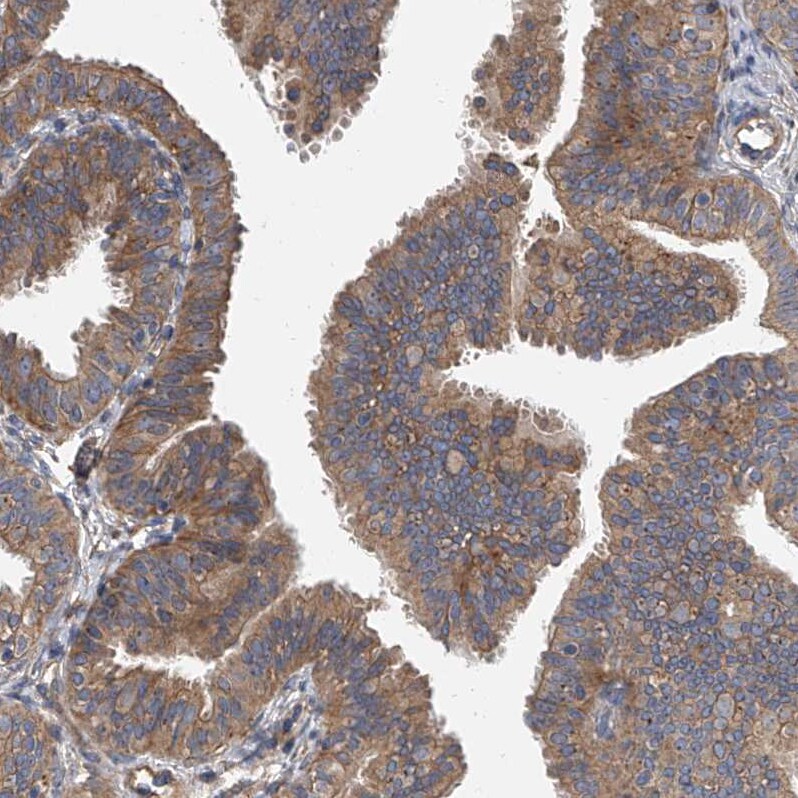 Sec8 Antibody - BSA Free Immunohistochemistry-Paraffin: Sec8 Antibody - BSA Free [NBP1-89597]