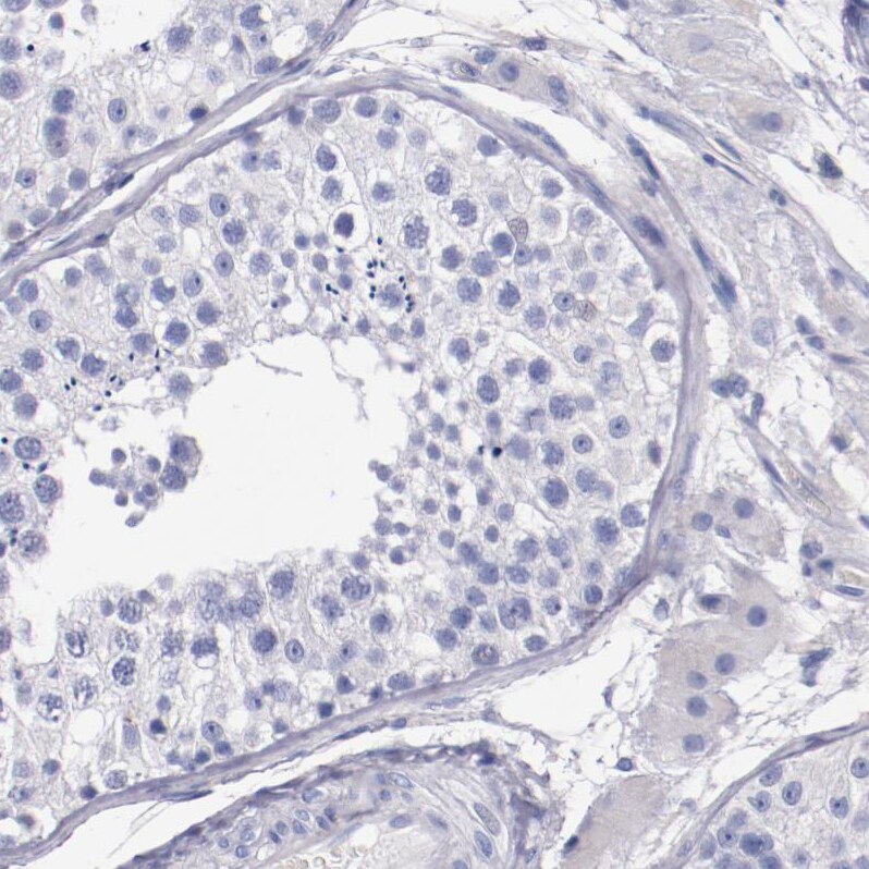 Periaxin Antibody - BSA Free Immunohistochemistry-Paraffin: Periaxin Antibody - BSA Free [NBP1-89598]