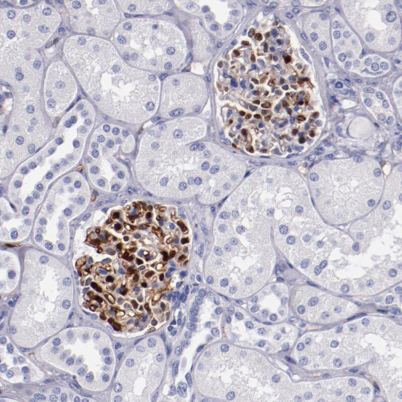 Periaxin Antibody - BSA Free Immunohistochemistry-Paraffin: Periaxin Antibody - BSA Free [NBP1-89598]
