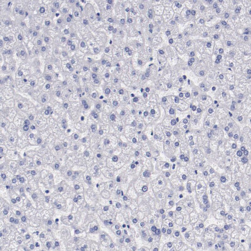 Periaxin Antibody - BSA Free Immunohistochemistry-Paraffin: Periaxin Antibody - BSA Free [NBP1-89598]