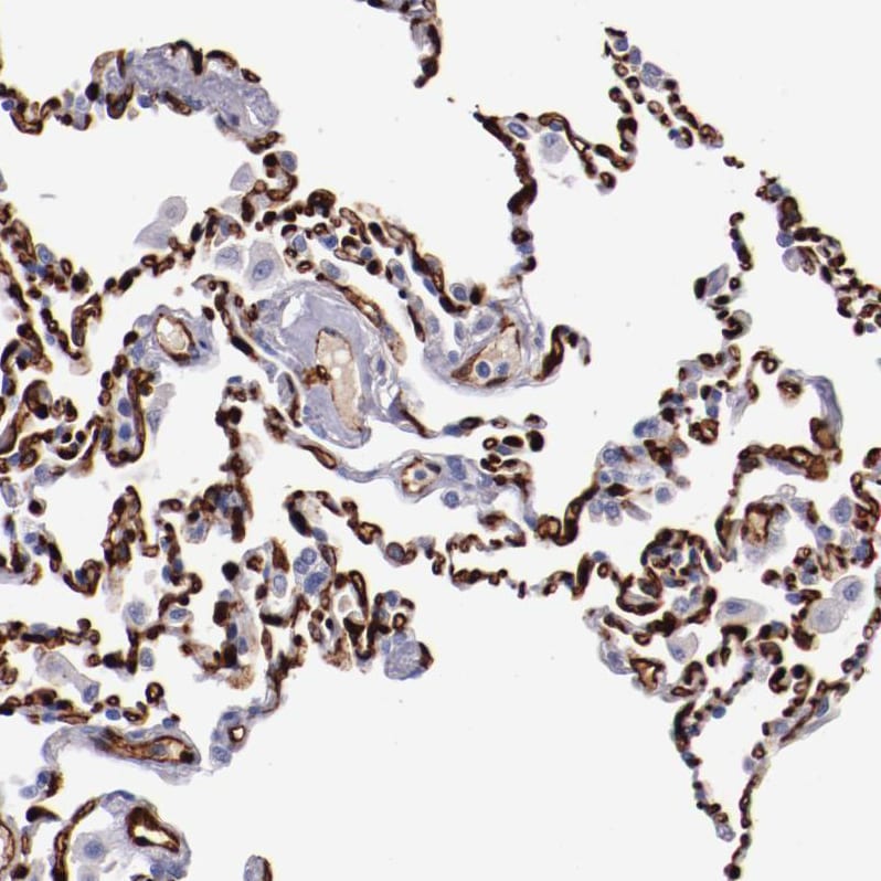 Periaxin Antibody - BSA Free Immunohistochemistry-Paraffin: Periaxin Antibody - BSA Free [NBP1-89598]