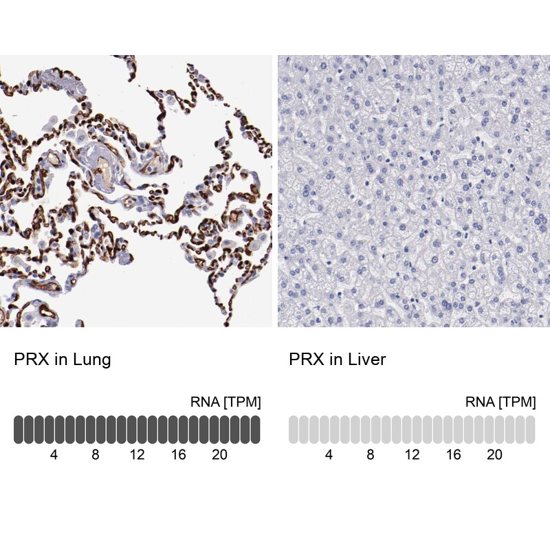 Periaxin Antibody - BSA Free Immunohistochemistry-Paraffin: Periaxin Antibody - BSA Free [NBP1-89598]
