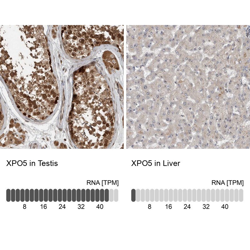 Exportin-5 Antibody - BSA Free Immunohistochemistry-Paraffin: Exportin-5 Antibody - BSA Free [NBP1-89605]