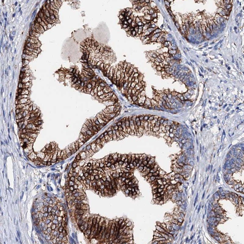 THRAP2 Antibody - BSA Free Immunohistochemistry-Paraffin: THRAP2 Antibody [NBP1-89612]