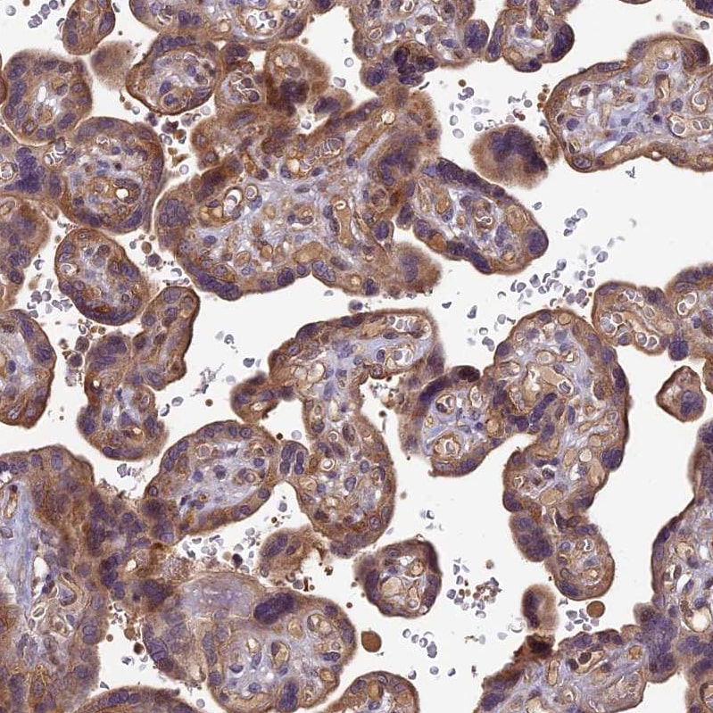 PIKFyve/PIP5K3 Antibody - BSA Free Immunohistochemistry-Paraffin: PIKFyve/PIP5K3 Antibody - BSA Free [NBP1-89613]