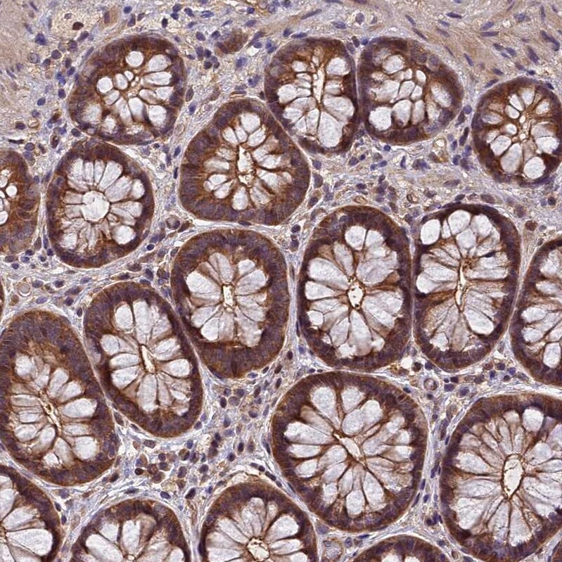 PIKFyve/PIP5K3 Antibody - BSA Free Immunohistochemistry-Paraffin: PIKFyve/PIP5K3 Antibody - BSA Free [NBP1-89613]