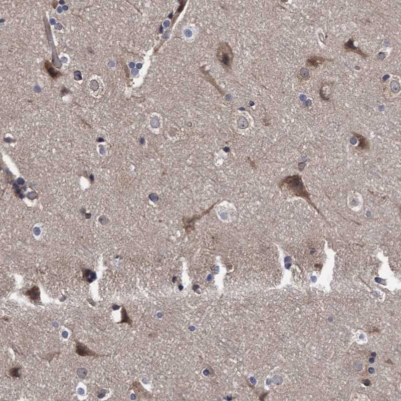 COBL Antibody - BSA Free Immunohistochemistry-Paraffin: COBL Antibody - BSA Free [NBP1-89615]