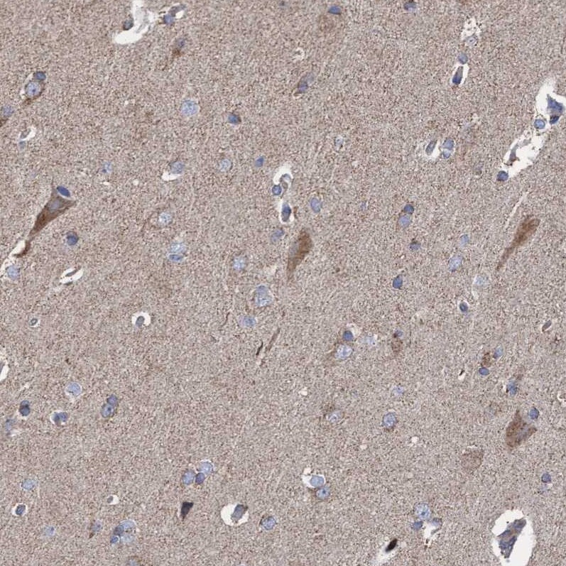 COBL Antibody - BSA Free Immunohistochemistry-Paraffin: COBL Antibody - BSA Free [NBP1-89616]