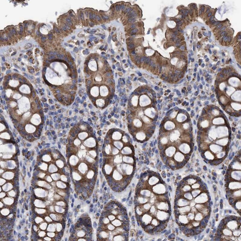 COBL Antibody - BSA Free Immunohistochemistry-Paraffin: COBL Antibody - BSA Free [NBP1-89616]