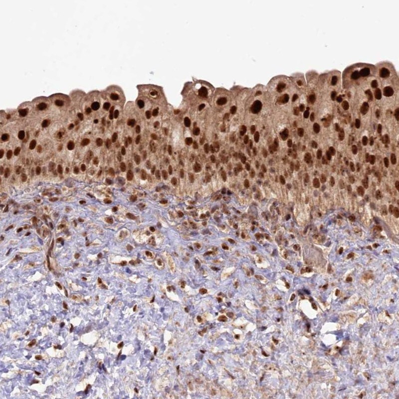 HUCE1 Antibody - BSA Free Immunohistochemistry-Paraffin: HUCE1 Antibody - BSA Free [NBP1-89618]
