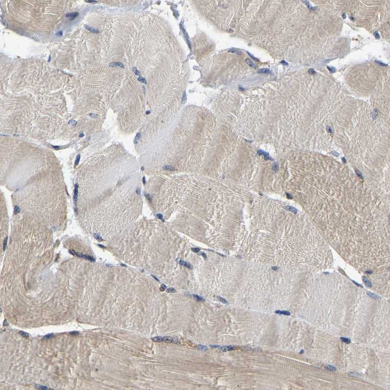 LARG Antibody - BSA Free Immunohistochemistry-Paraffin: LARG Antibody - BSA Free [NBP1-89619]