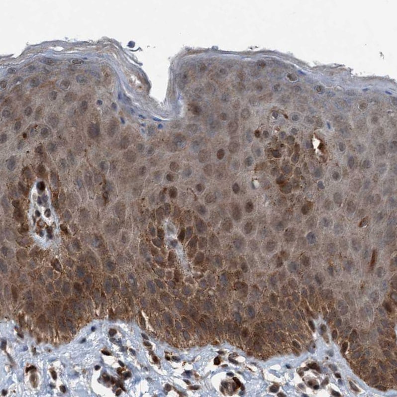 Plexin B2 Antibody - BSA Free Immunohistochemistry-Paraffin: Plexin B2 Antibody - BSA Free [NBP1-89620]