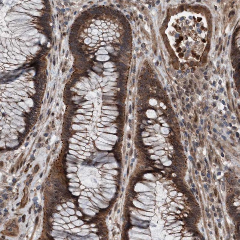 Plexin B2 Antibody - BSA Free Immunohistochemistry-Paraffin: Plexin B2 Antibody - BSA Free [NBP1-89620]