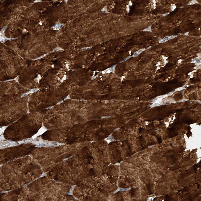 PUM2 Antibody - BSA Free Immunohistochemistry-Paraffin: PUM2 Antibody - BSA Free [NBP1-89623]