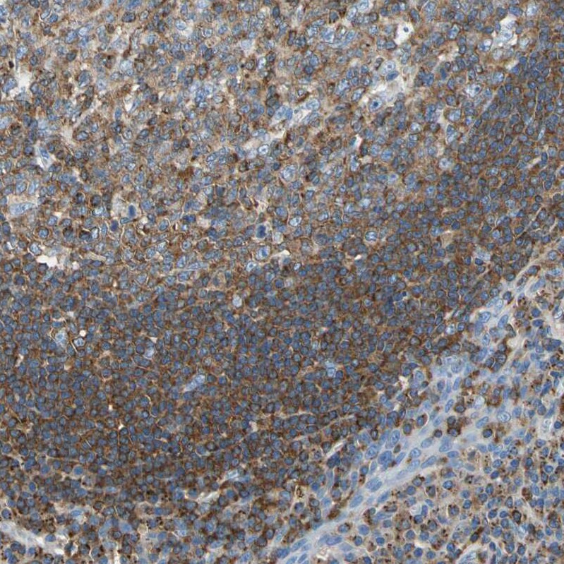 Septin-6 Antibody - BSA Free Immunohistochemistry-Paraffin: Septin-6 Antibody - BSA Free [NBP1-89626]