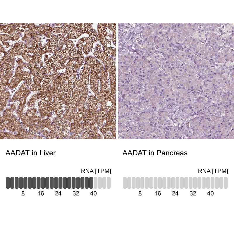 alpha-Aminoadipate Aminotransferase Antibody - BSA Free Immunohistochemistry-Paraffin: alpha-Aminoadipate Aminotransferase Antibody - BSA Free [NBP1-89627]