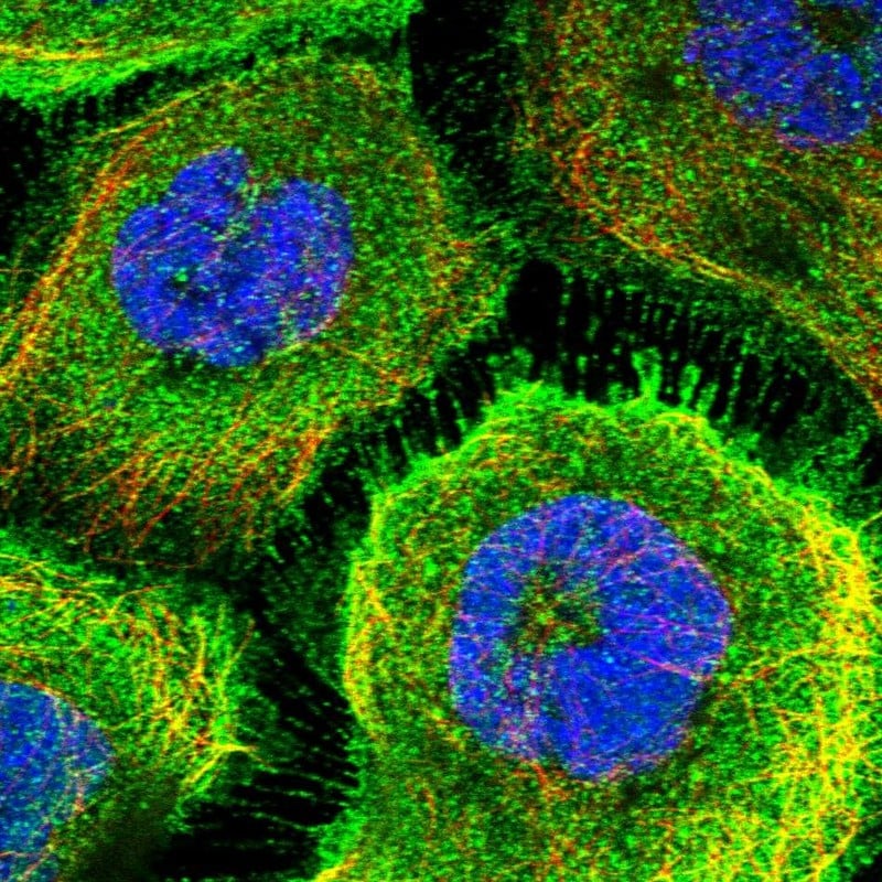 alpha-Aminoadipate Aminotransferase Antibody - BSA Free Immunocytochemistry/ Immunofluorescence: alpha-Aminoadipate Aminotransferase Antibody - BSA Free [NBP1-89627]