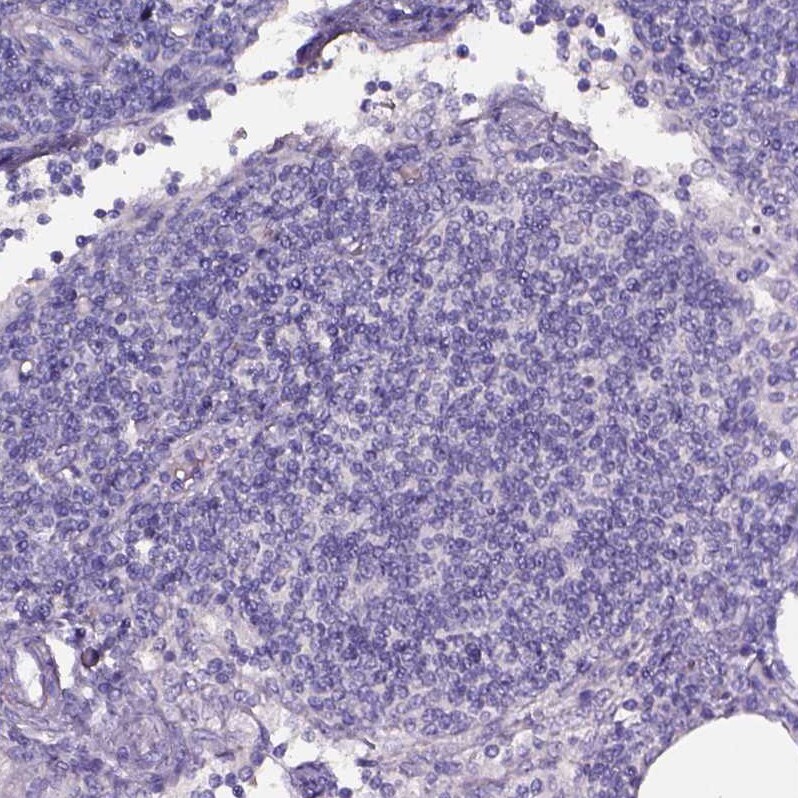 alpha-Aminoadipate Aminotransferase Antibody - BSA Free Immunohistochemistry-Paraffin: alpha-Aminoadipate Aminotransferase Antibody - BSA Free [NBP1-89627]