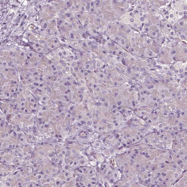 alpha-Aminoadipate Aminotransferase Antibody - BSA Free Immunohistochemistry-Paraffin: alpha-Aminoadipate Aminotransferase Antibody - BSA Free [NBP1-89627]