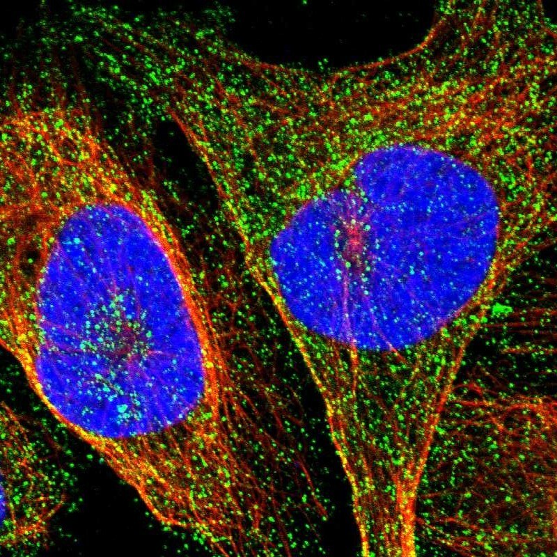 SLC45A3/Prostein Antibody - BSA Free Immunocytochemistry/ Immunofluorescence: SLC45A3/Prostein Antibody [NBP1-89629]