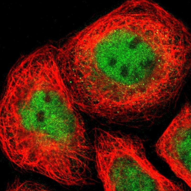 IKK alpha Antibody - BSA Free Immunocytochemistry/ Immunofluorescence: IKK alpha Antibody [NBP1-89634]