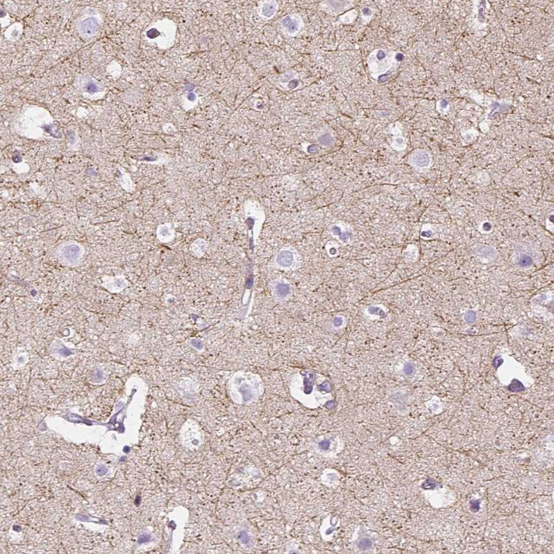 IGSF4C/SynCAM4 Antibody - BSA Free Immunohistochemistry-Paraffin: IGSF4C/SynCAM4 Antibody - BSA Free [NBP1-89636]