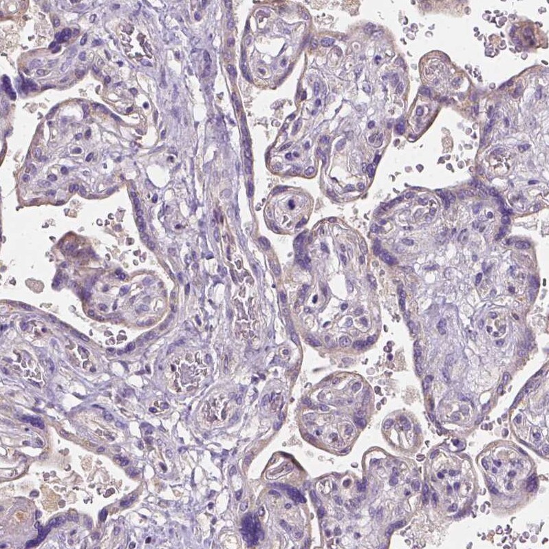 IGSF4C/SynCAM4 Antibody - BSA Free Immunohistochemistry-Paraffin: IGSF4C/SynCAM4 Antibody - BSA Free [NBP1-89636]