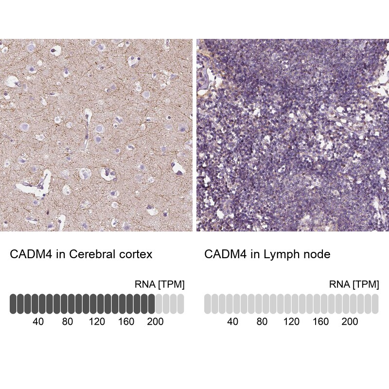 IGSF4C/SynCAM4 Antibody - BSA Free Immunohistochemistry-Paraffin: IGSF4C/SynCAM4 Antibody - BSA Free [NBP1-89636]