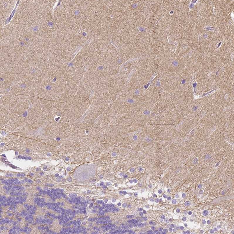 IGSF4C/SynCAM4 Antibody - BSA Free Immunohistochemistry-Paraffin: IGSF4C/SynCAM4 Antibody - BSA Free [NBP1-89636]