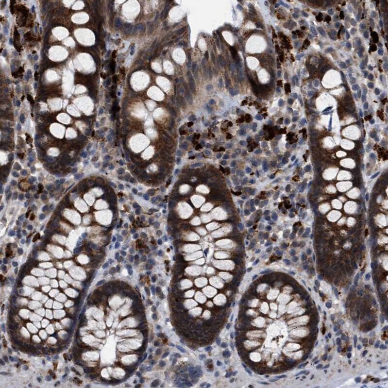 RENT1/UPF1/hUPF1 Antibody - BSA Free Immunohistochemistry-Paraffin: RENT1/UPF1/hUPF1 Antibody - BSA Free [NBP1-89641]