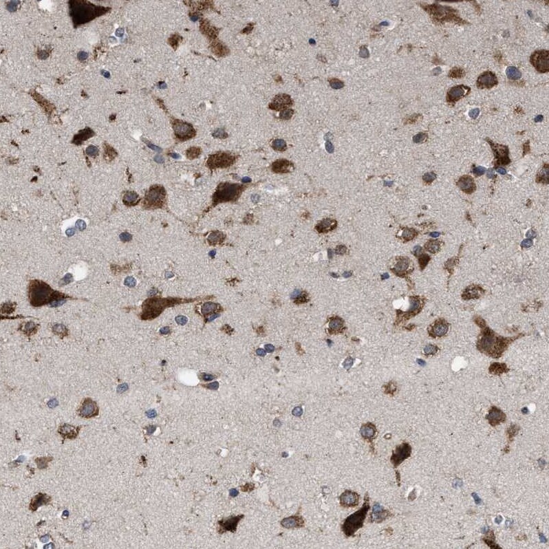 RENT1/UPF1/hUPF1 Antibody - BSA Free Immunohistochemistry-Paraffin: RENT1/UPF1/hUPF1 Antibody - BSA Free [NBP1-89641]