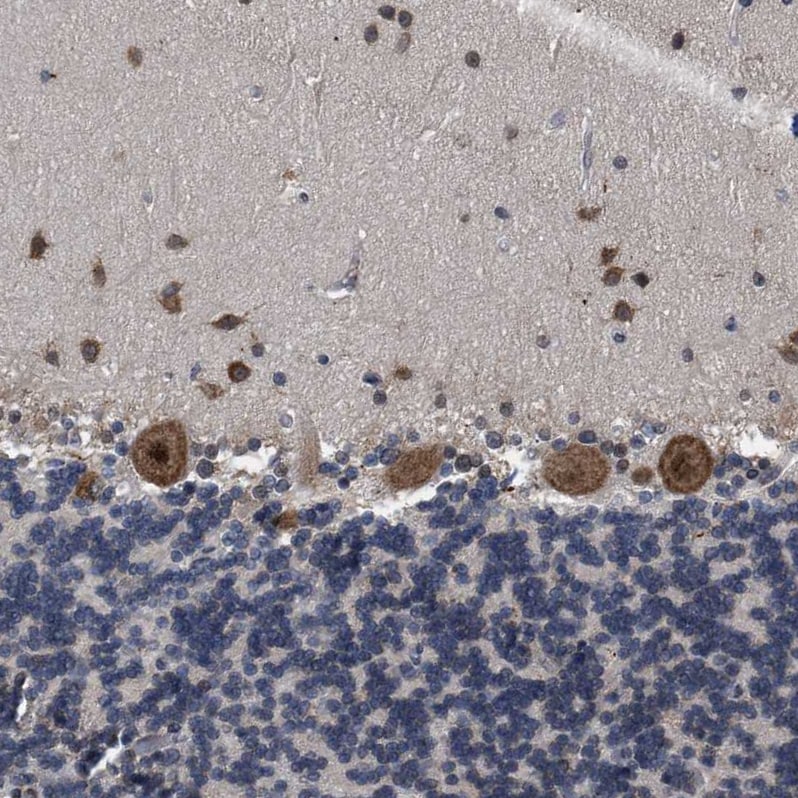 RENT1/UPF1/hUPF1 Antibody - BSA Free Immunohistochemistry-Paraffin: RENT1/UPF1/hUPF1 Antibody - BSA Free [NBP1-89641]