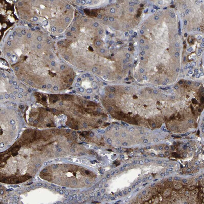 Monoglyceride Lipase Antibody Immunohistochemistry: Monoglyceride Lipase Antibody [Monoglyceride Lipase Antibody]