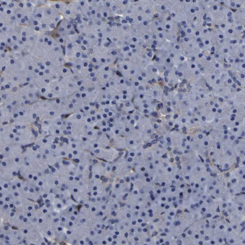 Monoglyceride Lipase Antibody Immunohistochemistry: Monoglyceride Lipase Antibody [Monoglyceride Lipase Antibody]