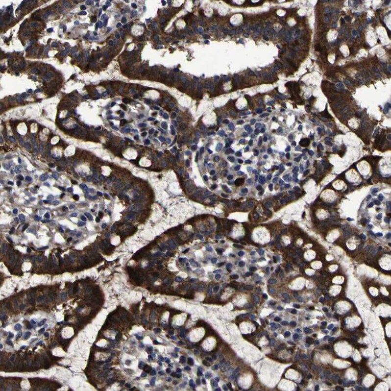 Monoglyceride Lipase Antibody Immunohistochemistry: Monoglyceride Lipase Antibody [Monoglyceride Lipase Antibody]