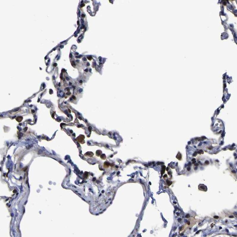 Monoglyceride Lipase Antibody Immunohistochemistry: Monoglyceride Lipase Antibody [Monoglyceride Lipase Antibody]