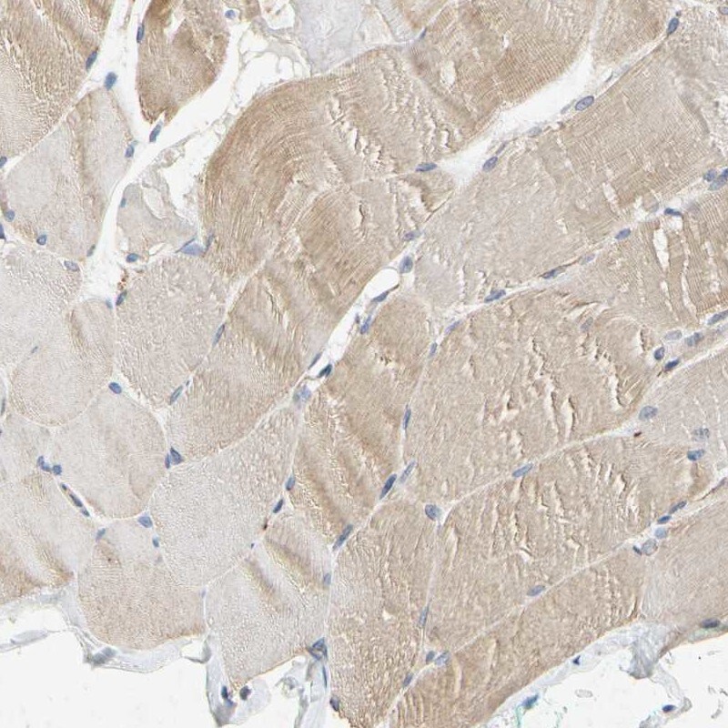RSK1 Antibody - BSA Free Immunohistochemistry-Paraffin: RSK1 Antibody [NBP1-89647]