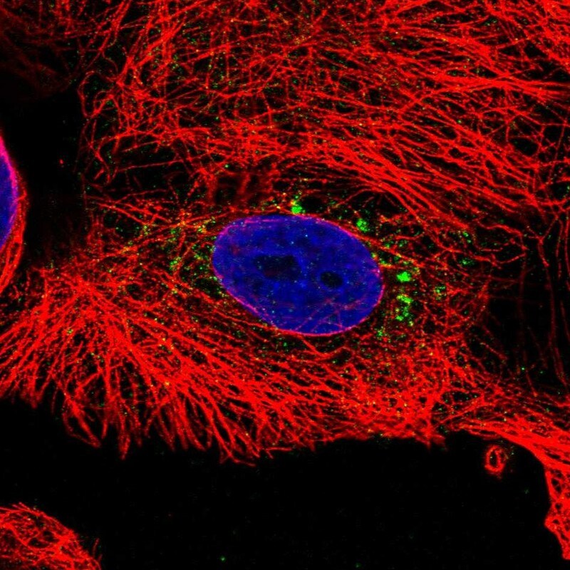 Transthyretin/Prealbumin Antibody - BSA Free Immunocytochemistry/ Immunofluorescence: Transthyretin/Prealbumin Antibody [NBP1-89649]