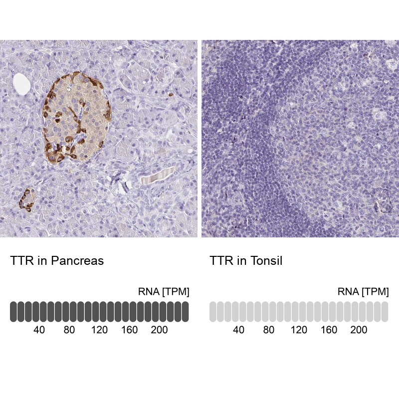 Transthyretin/Prealbumin Antibody - BSA Free Immunohistochemistry-Paraffin: Transthyretin/Prealbumin Antibody - BSA Free [NBP1-89649]