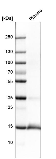 Transthyretin/Prealbumin Antibody - BSA Free Western Blot: Transthyretin/Prealbumin Antibody - BSA Free [NBP1-89649]