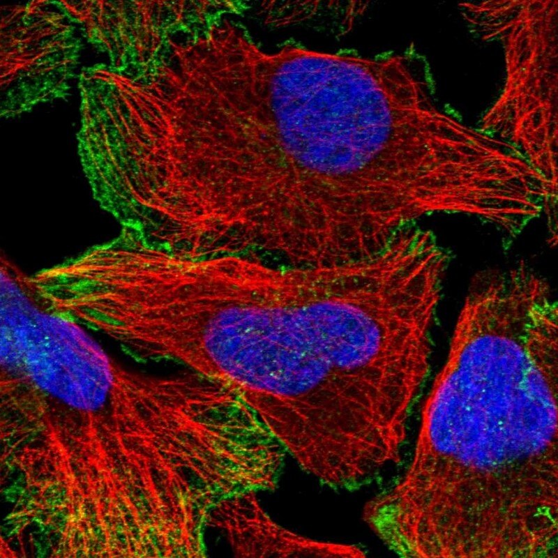 Neogenin Antibody - BSA Free Immunocytochemistry/ Immunofluorescence: Neogenin Antibody [NBP1-89651]
