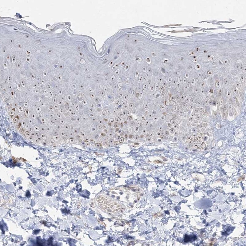 HSPC111 Antibody - BSA Free Immunohistochemistry-Paraffin: HSPC111 Antibody - BSA Free [NBP1-89659]