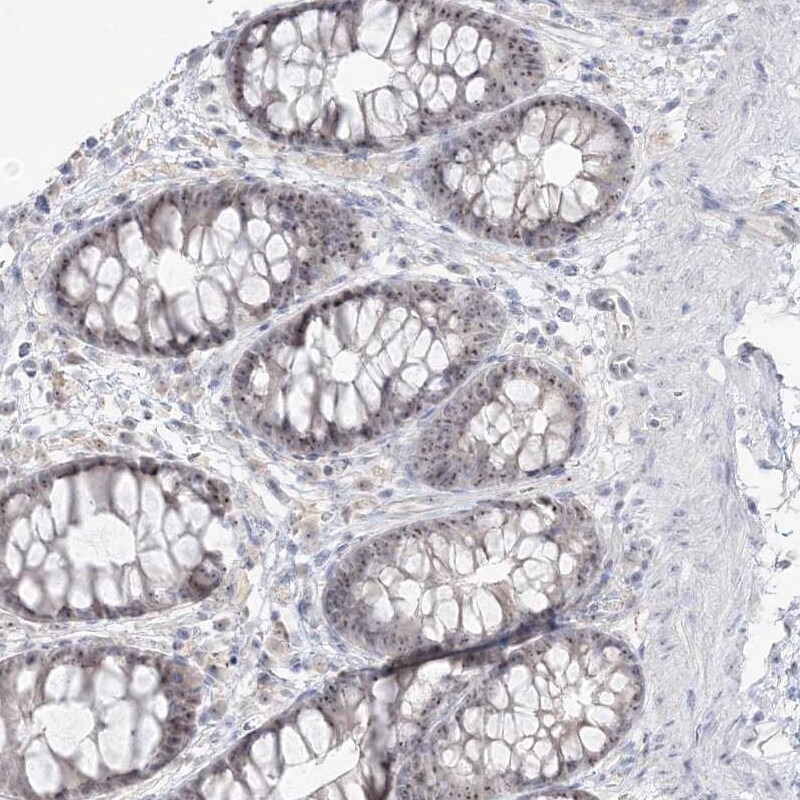 HSPC111 Antibody - BSA Free Immunohistochemistry-Paraffin: HSPC111 Antibody - BSA Free [NBP1-89659]
